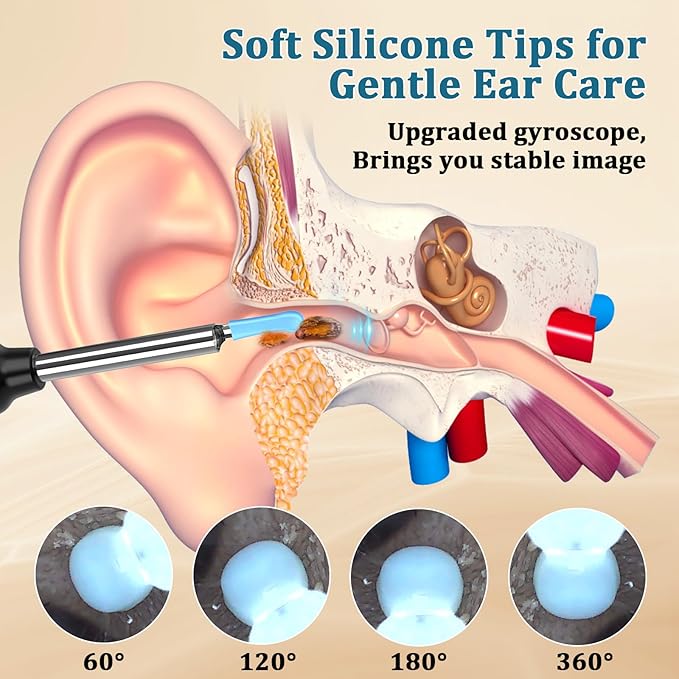 Ear Wax Cleaning Device With 1080p Quality Camera (FREE SHIPPING)